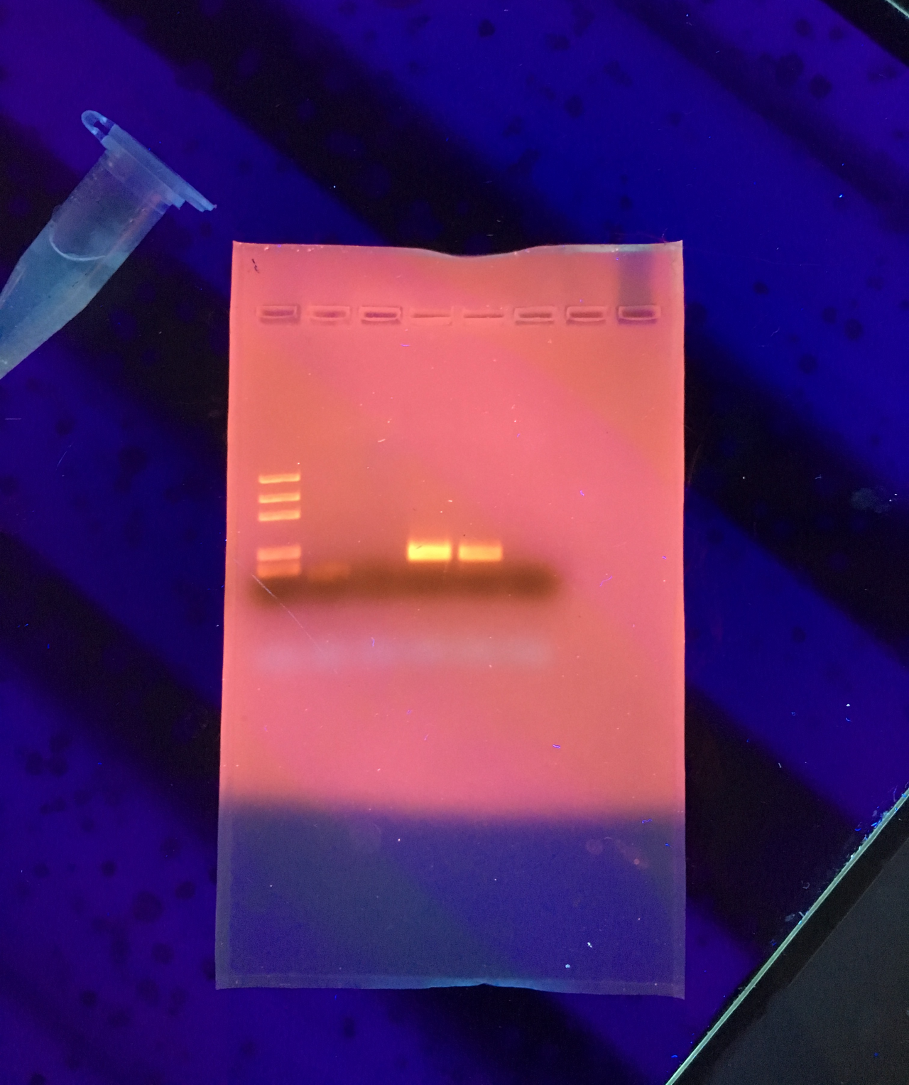 Gel de agarosa con fragmentos de ADN separados tras electroforesis