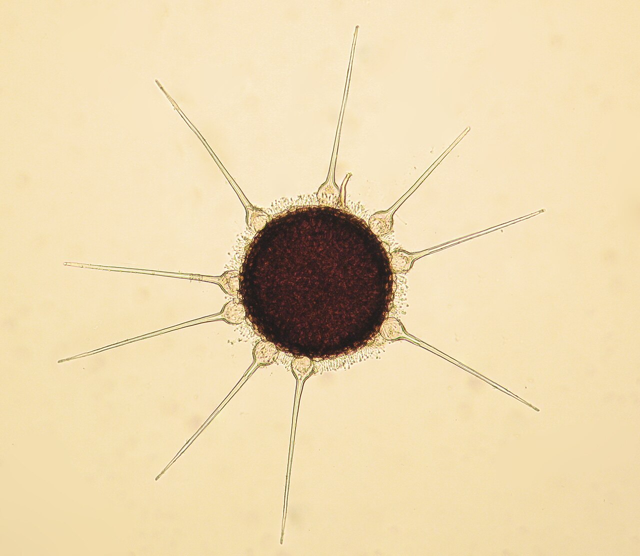 Cleistotecio del mildio polvoroso Phyllactinia guttata en una hoja de avellana bajo aumento