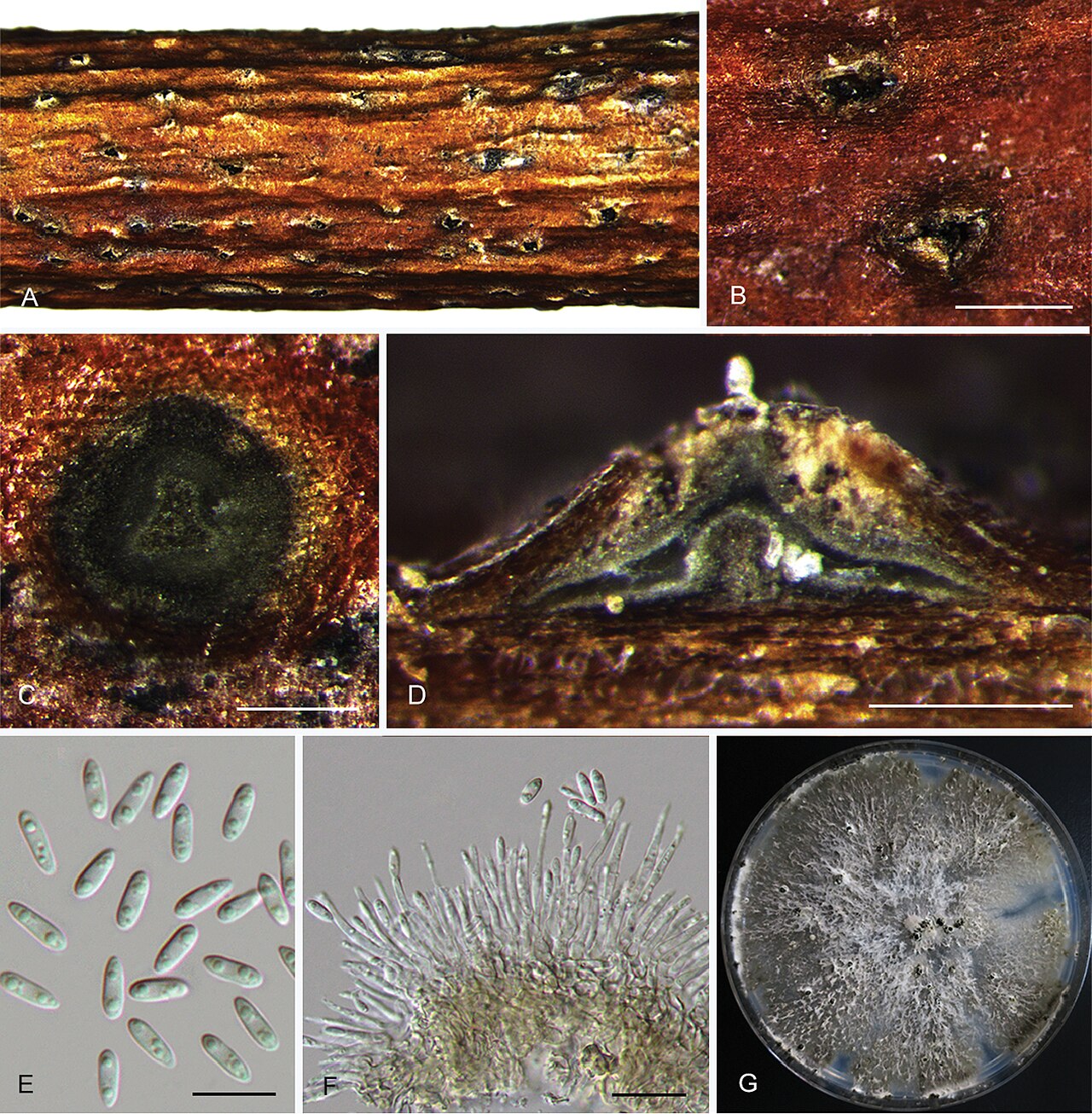 Diaporthe eres (anamorfo Phomopsis) — vista microscópica de cuerpos fructíferos y esporas del hongo del complejo de cancro de ramas