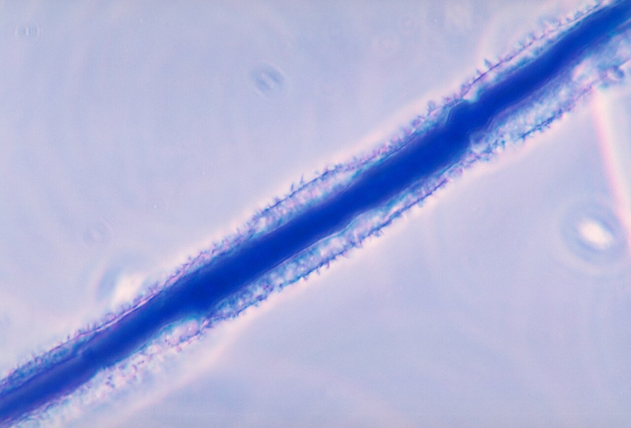 Moho del género Aspergillus flavus, causante de aflatoxinas que amenazan al fruto poco secado