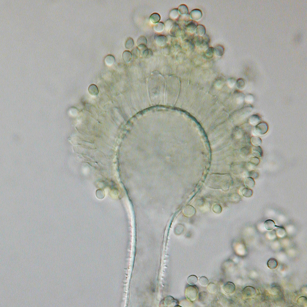 Conidióforo de moho Aspergillus flavus bajo microscopio, causante de aflatoxinas por un mal secado